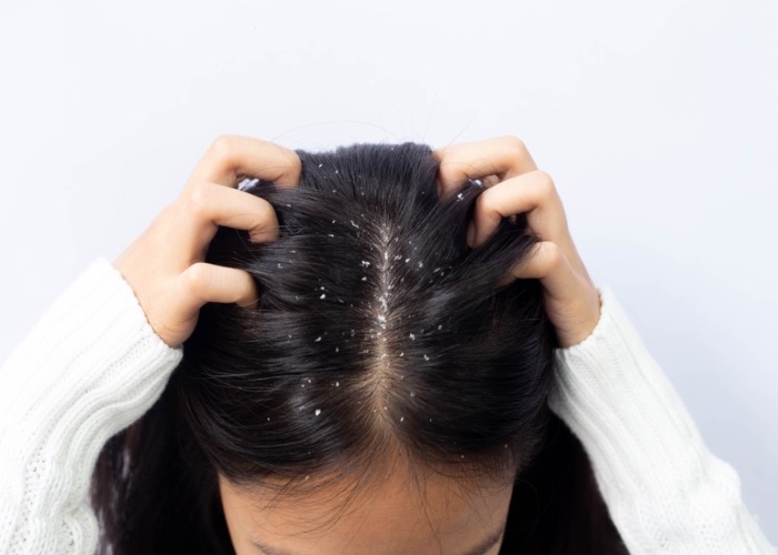 Hair loss outlet after smoothing treatment